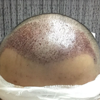 發(fā)際線用戶圖片