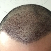 發(fā)際線用戶圖片