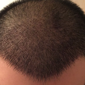 发际线分享社区