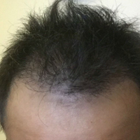 發(fā)際線用戶圖片