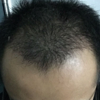 發(fā)際線用戶圖片