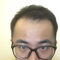 發(fā)際線用戶圖片