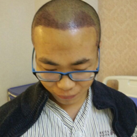 發(fā)際線用戶圖片