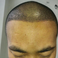 發(fā)際線用戶圖片