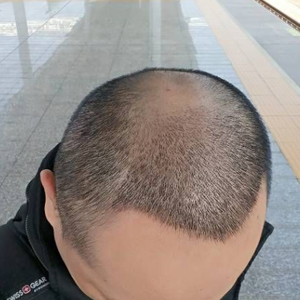 发际线分享社区