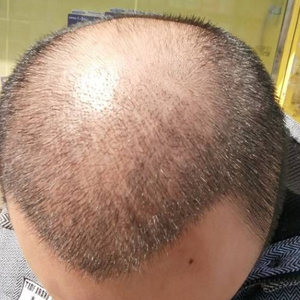 发际线分享社区