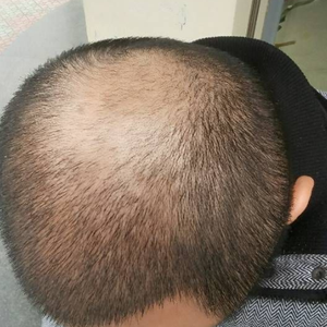 发际线分享社区
