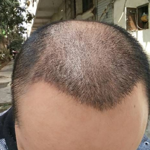 发际线分享社区