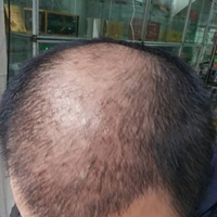 發(fā)際線用戶圖片