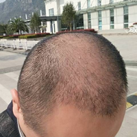 發(fā)際線用戶圖片