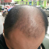 發(fā)際線用戶圖片
