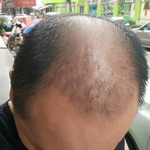 发际线分享社区