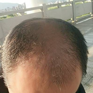 发际线分享社区