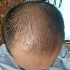 发际线分享社区