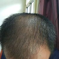 發(fā)際線用戶圖片