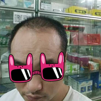 發(fā)際線用戶圖片