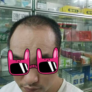 发际线分享社区