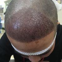 發(fā)際線用戶圖片