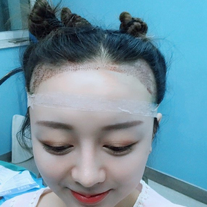 发际线分享社区