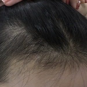 发际线分享社区