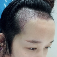 發(fā)際線用戶圖片