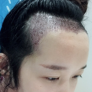 发际线分享社区