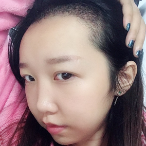 发际线分享社区