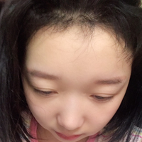 發(fā)際線用戶圖片