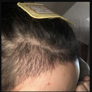 发际线分享社区