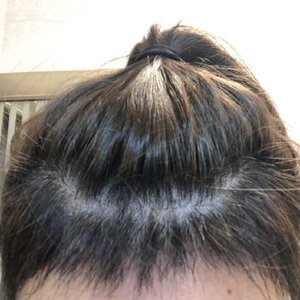 发际线分享社区