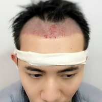發(fā)際線(xiàn)用戶(hù)圖片