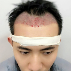 发际线分享社区