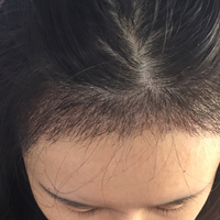發(fā)際線用戶圖片