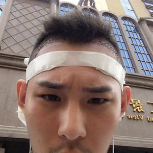 发际线分享社区