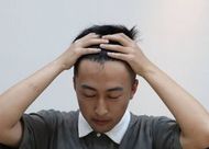 脫發(fā)會不會傳染？日常三點做到了嗎