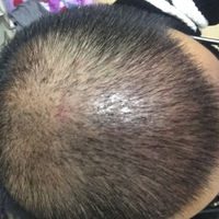 發(fā)際線用戶圖片