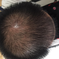 發(fā)際線用戶圖片