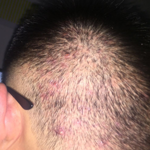 发际线分享社区