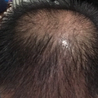 發(fā)際線用戶圖片