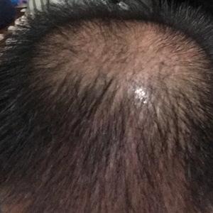 发际线分享社区