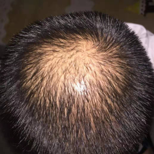 发际线分享社区