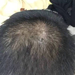 发际线分享社区