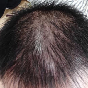 发际线分享社区