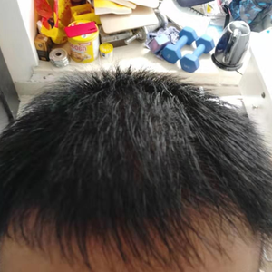 发际线分享社区