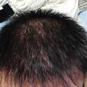 发际线分享社区