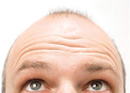 做植发手术对脱发真的有效果吗？常用的两种治疗手法