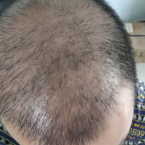 发际线分享社区