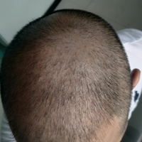 發(fā)際線用戶圖片