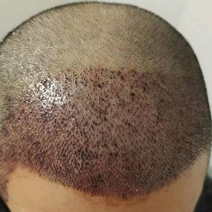 发际线分享社区