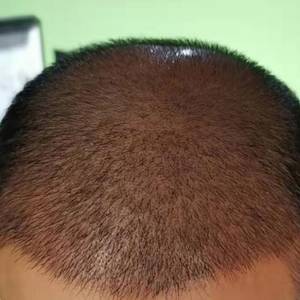 发际线分享社区